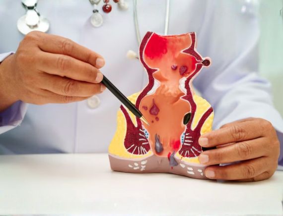 Gall Bladder Treatment